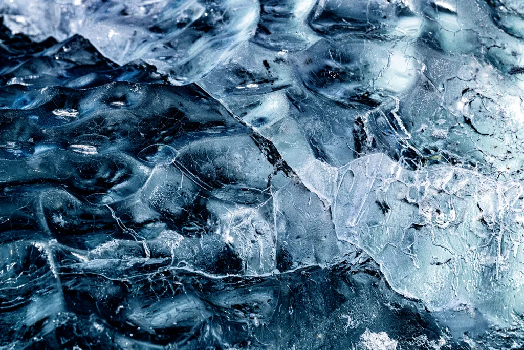 Cryothérapie