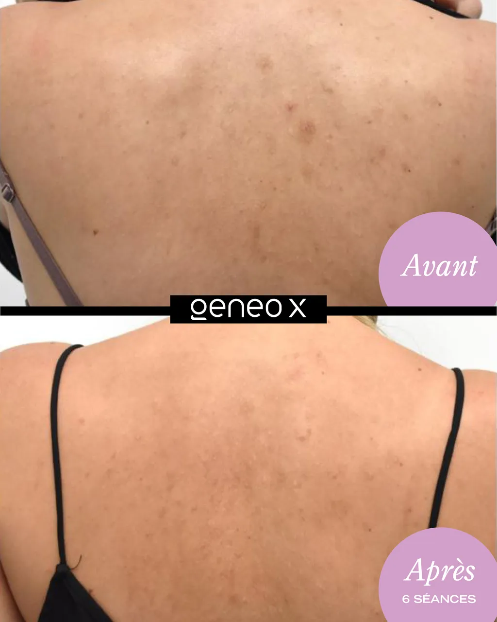 Peau détoxifiée et pores resserrés